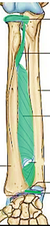 <p>Top green line</p>