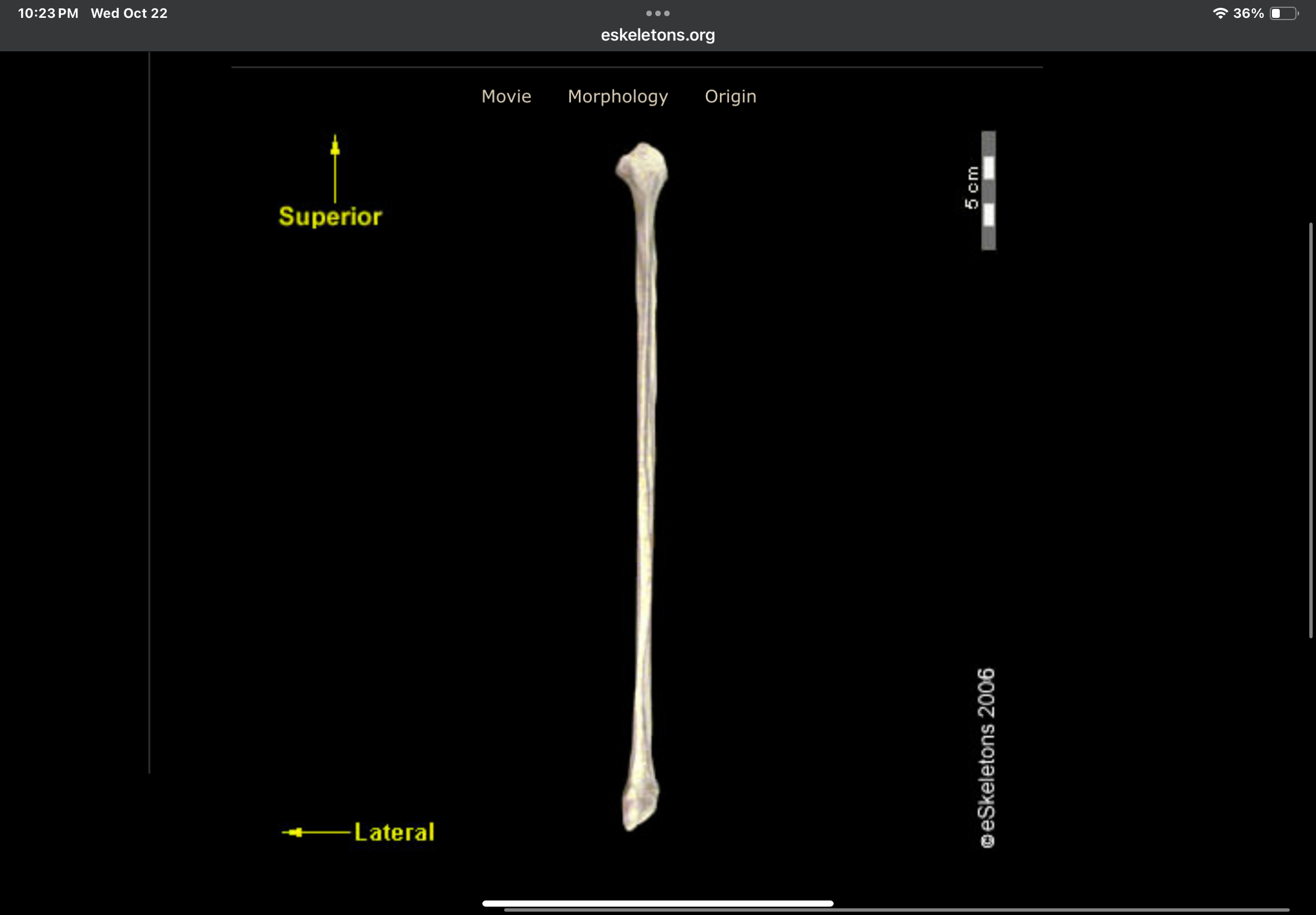 <p>Bone?</p>