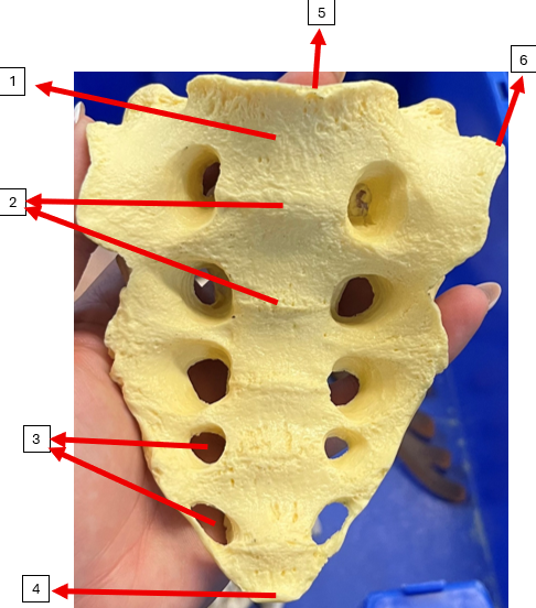 <p>3F</p>