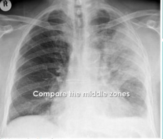 <p>What is this? and what causes it?</p>