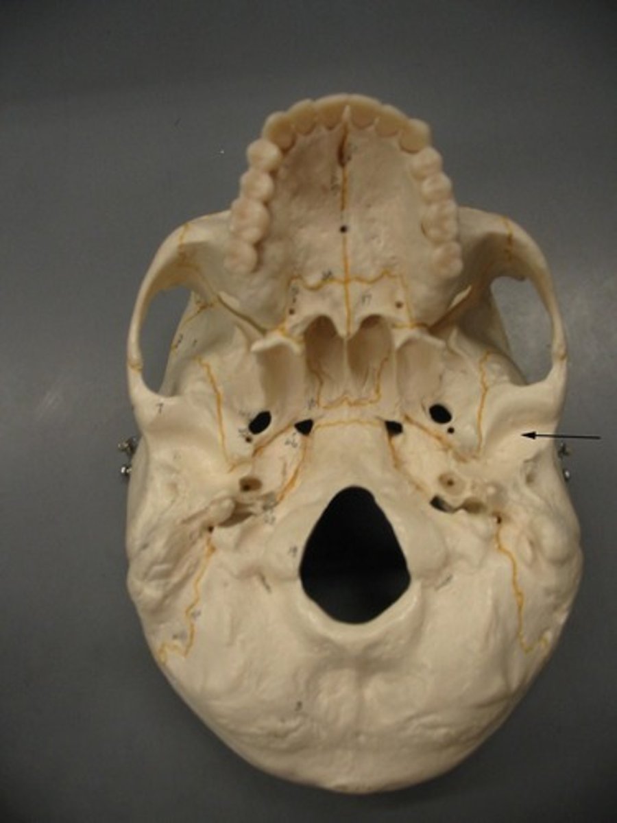 <p>the depression in the temporal bone into which the condyle of the mandible fits</p>