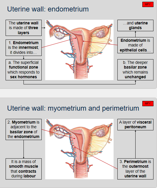 <ol><li><p>The uterine wall is made up of three layers: the endometrium, the myometrium, and the perimetrium.</p></li><li><p>The endometrium is the innermost layer of the uterine wall.</p></li><li><p>The endometrium is divided into two zones: the superficial functional zone and the deeper basilar zone.</p></li><li><p>The superficial functional zone responds to sex hormones.</p></li><li><p>The deeper basilar zone remains unchanged.</p></li><li><p>The endometrium is made of epithelial cells and uterine glands.</p></li><li><p>The myometrium is a mass of smooth muscle in the uterine wall that is adjacent to the basilar zone of the endometrium. It is responsible for contracting during labor to help expel the fetus and placenta from the uterus.</p></li><li><p>The perimetrium is the outermost layer of the uterine wall. It is a layer of visceral peritoneum.</p></li></ol>