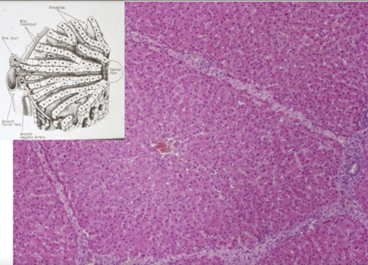 <p>how is this parenchyma organized- acini, nodules, or cords?</p>