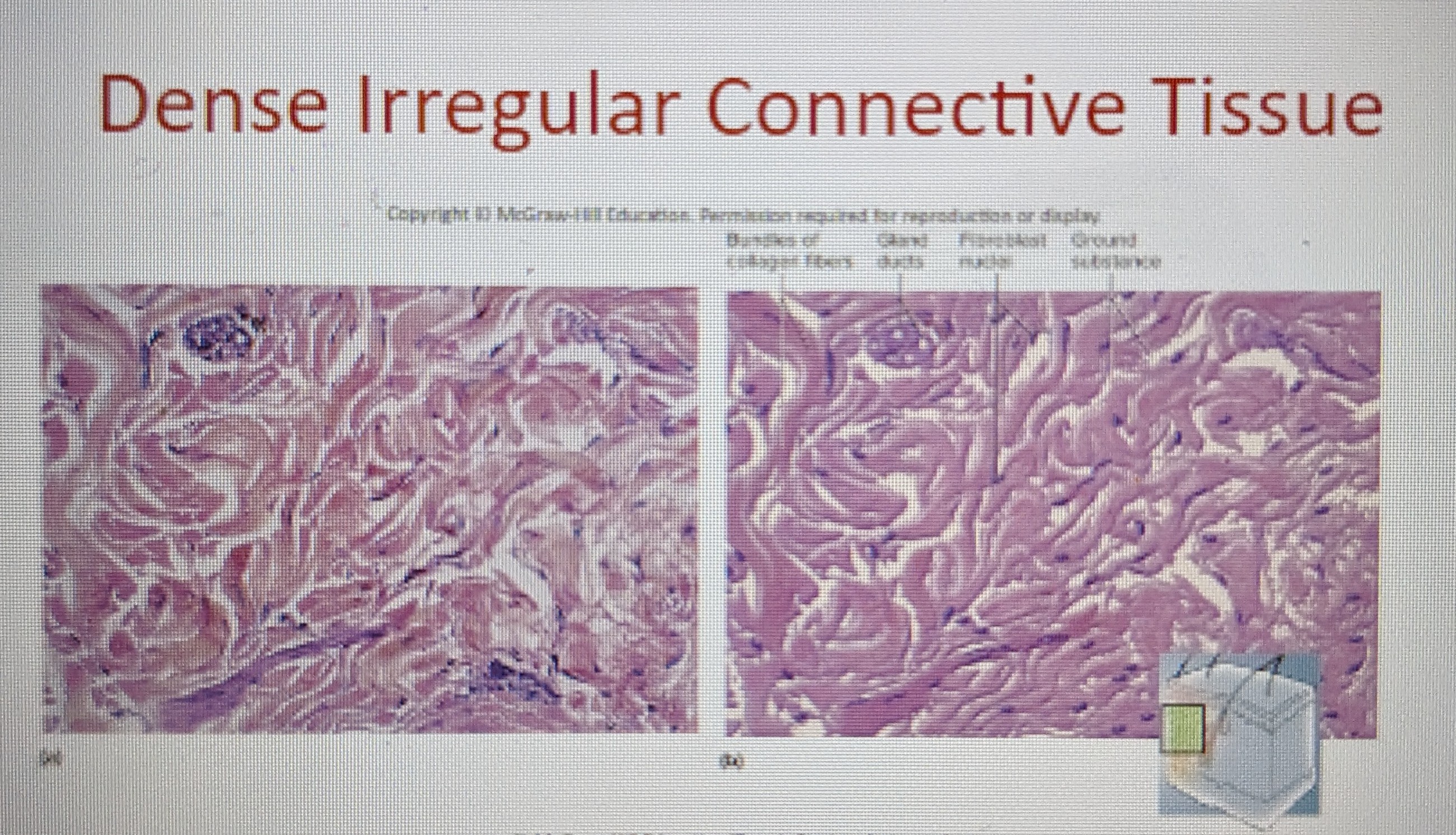 * densely packed, randomly arranged, collagen fibers and few visible cells 
* withstands unpredictable stresses 
* in deeper layer of skin; capsules around organs 
* has medium resistance in all directions