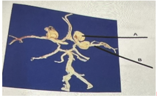 <p>B in the above photo represents</p><p>a. Cerebral artery</p><p>b. Common carotid artery</p><p>c. Cerebellar artery</p><p>d. Internal carotid artery</p>