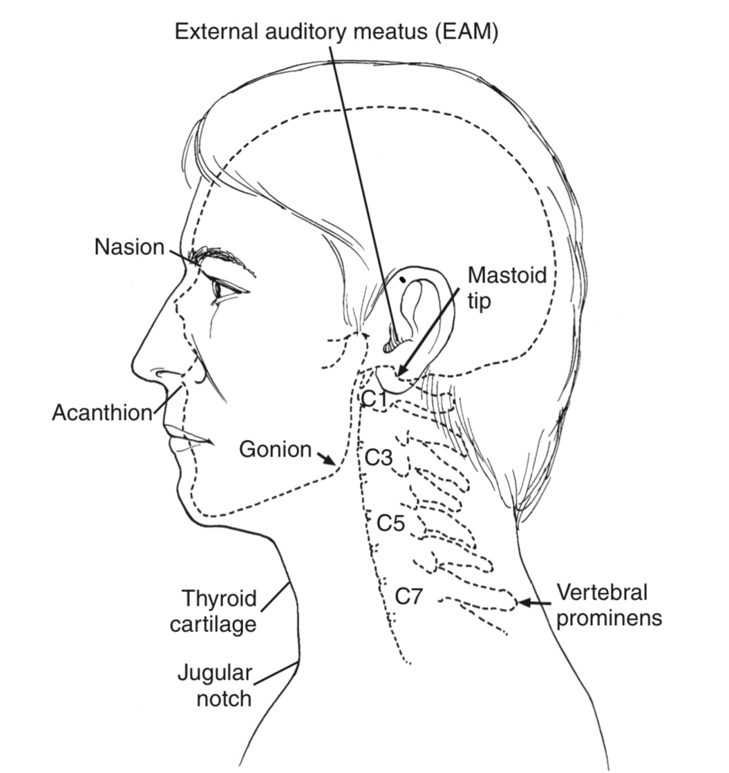 <p>Vertebral prominens</p>