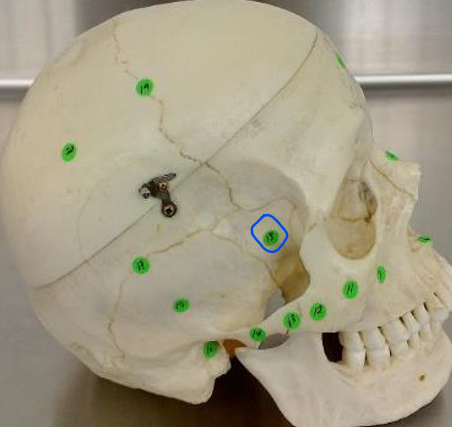 <p>#18 (lateral skull)</p>