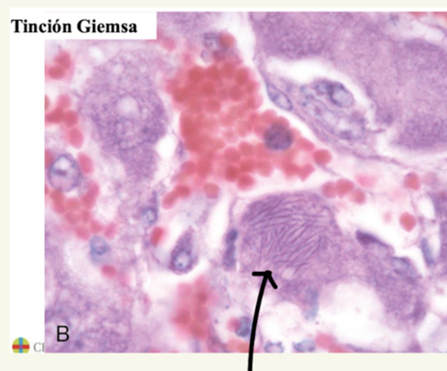 <p>hígado.</p><p>¿diagnóstico y etiología?</p>