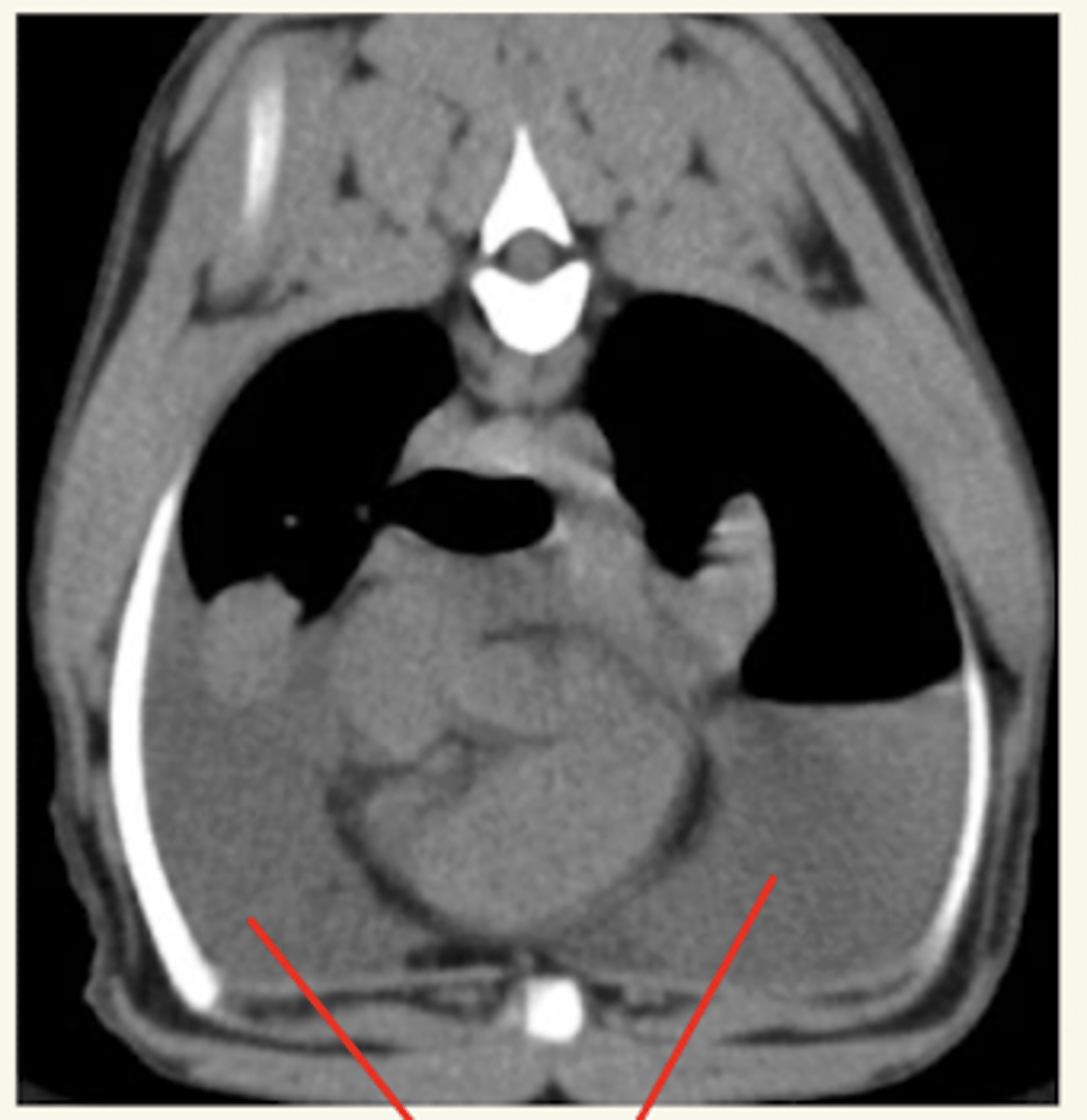 <p>líquido (gris) en la zona ventral de los pulmones (cae por gravedad)</p>
