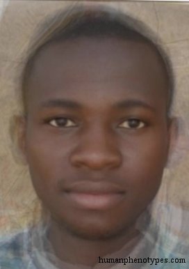 <p>Identify this Phenotype</p>