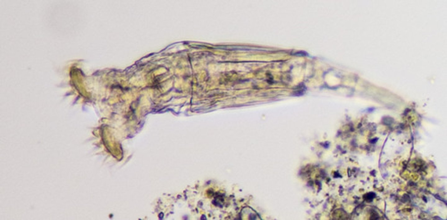 <p>Mikroskopiska</p><p>Vattenlevande (fukt)</p><p>Viktigt zooplankton</p><p>Mun - anus (dvs genomgående tarm)</p><p>Coelomvätskan - hydrostatiskt skelett</p><p>Pseudocoelomat</p><p>Ciliekrona i framänden</p><p>Äter mikroorganismer (bakterier, alger etc)</p><p>Ovanliga fortplantningsmekanismer</p>