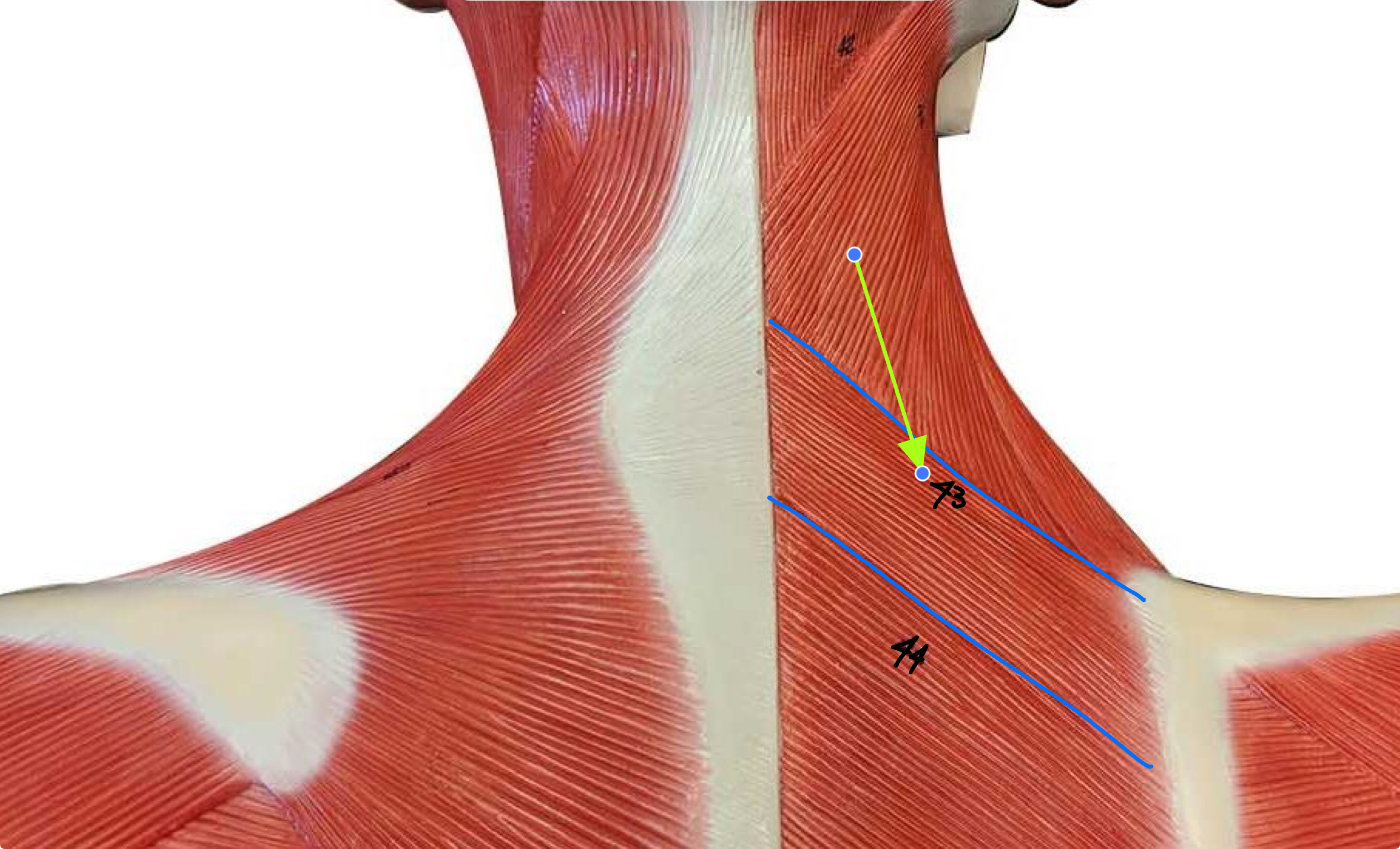 <p>What type of muscle is this ( altay model )</p>