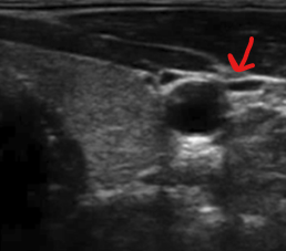 <p>Identify this image. </p>