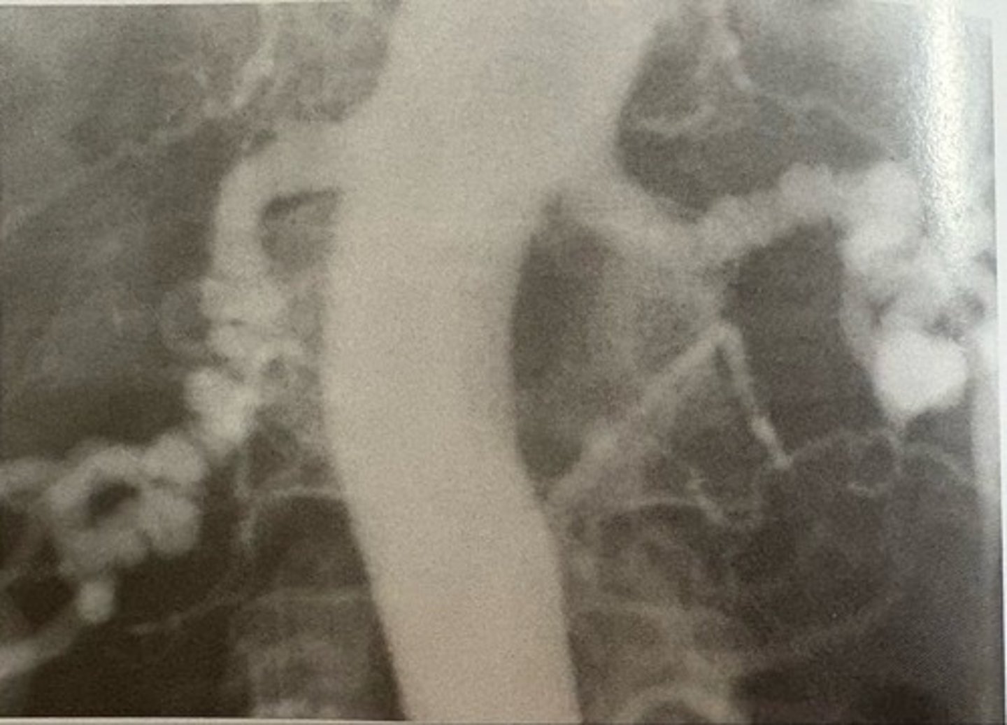 <p>what pathology is present?</p>