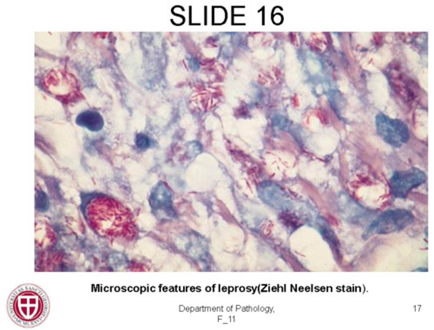 <p>acid-fast stain</p>