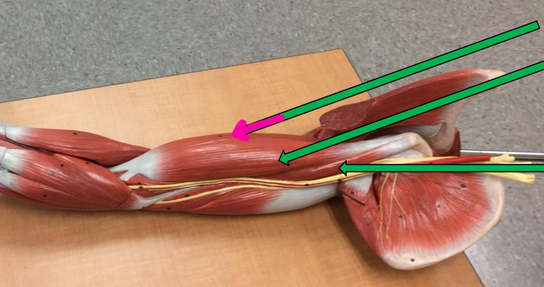 <p>Identify this muscle?</p>