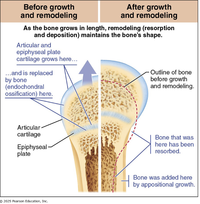 <ul><li><p>As the long bone lengthens, the shape of the ends must be altered (remodeling)</p></li><li><p>Remember that the epiphyseal plates are located in the wider parts of long bones </p></li><li><p>Bone has to be reshaped to be incorporated into the diaphysis, but the diaphysis also has to be get thicker and stronger as the bone lengthens</p></li><li><p>In summary, bone is destroyed by osteoclasts and laid down by osteoblasts on both the inner and outer surfaces of a growing long bone</p></li></ul><p></p>