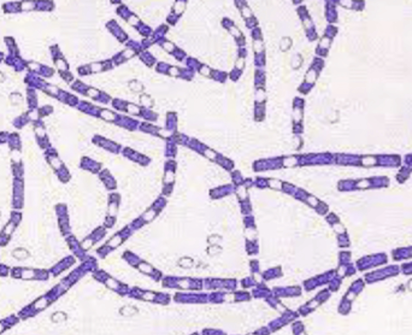 <p>what bacteria is this?</p>