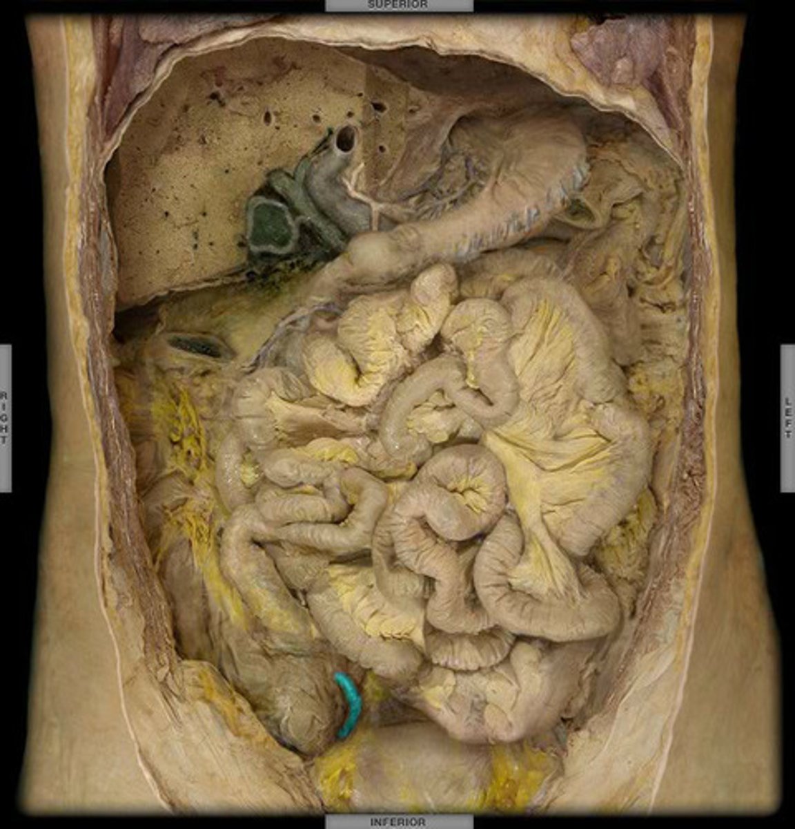 <p>A small, fingerlike extension of the vertebrate cecum; contains a mass of white blood cells that contribute to immunity.1</p>