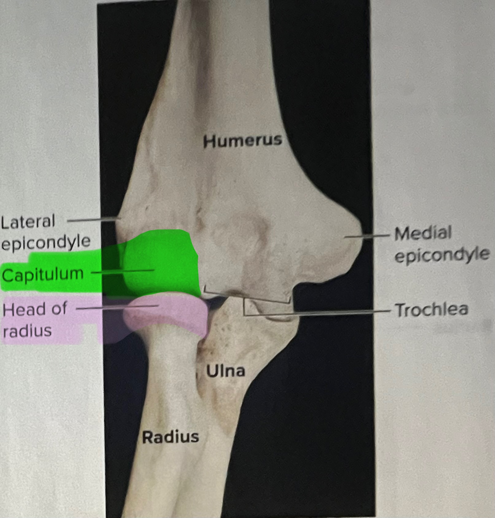<p>The capitulum of the humerus articulates with the head of the radius, forming the humeroradial joint  </p>