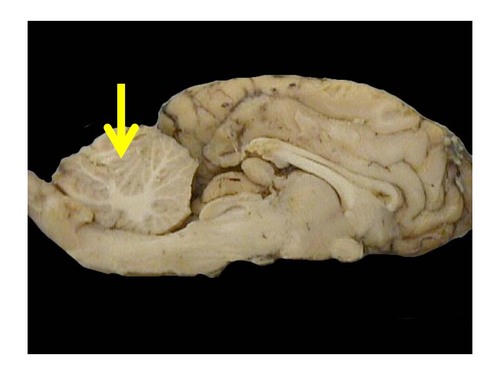 <p>Cerebellum</p>