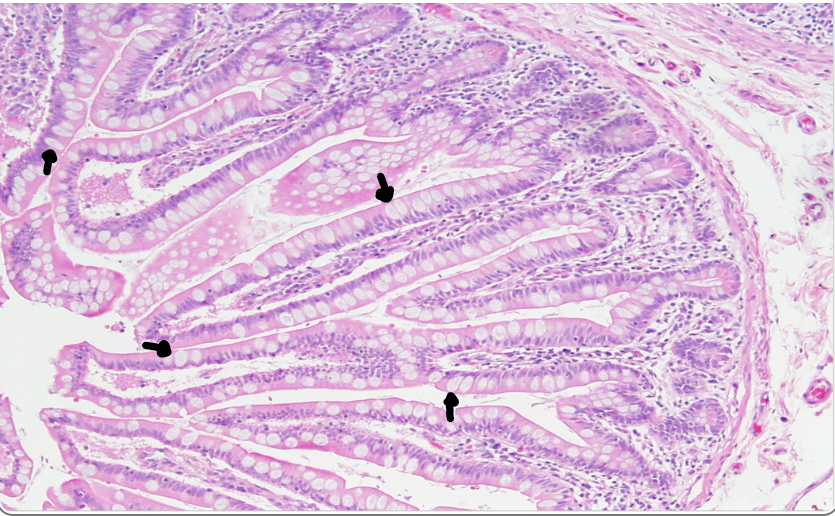 <p>the arrows point to </p>