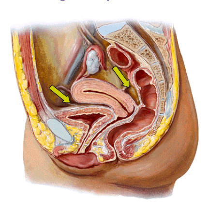 deeper in peritoneal space vertically, pelvic abscess location;
vesicouterine pouch, between uterus and bladder