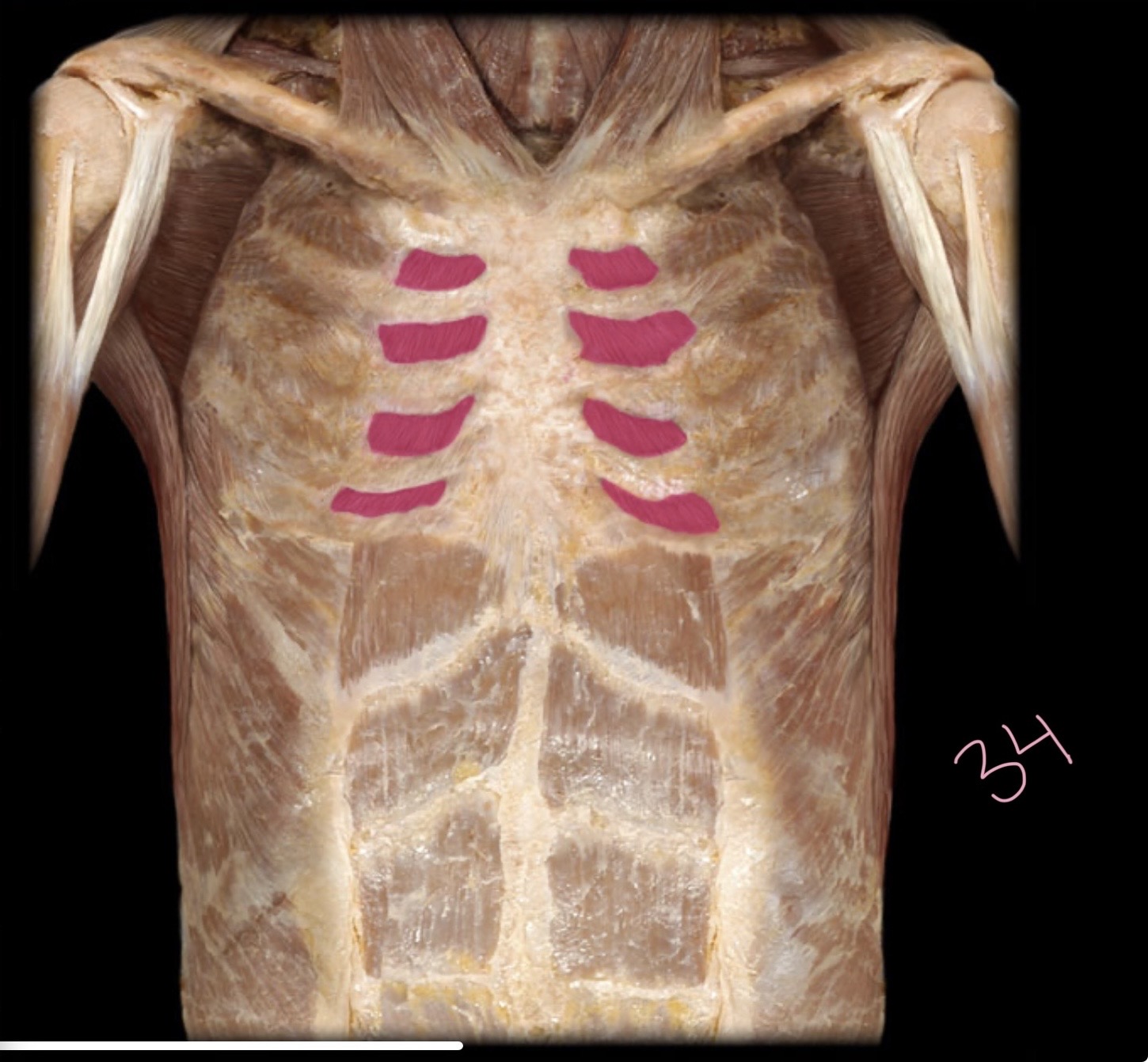 <p>Internal intercostal</p>