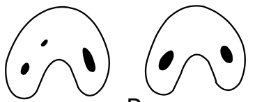 <p><span>2-3 separate canals and both angles are less than 60 degrees</span></p>