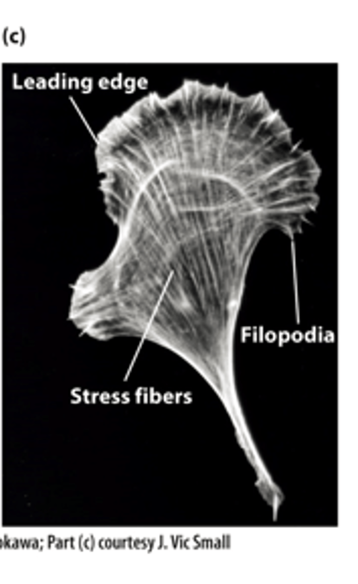 <p>Staining actin microfilaments with fluorescent ____________, a drug that specifically binds F-actin, reveals different microfilament organizations in a moving cell led by the leading edge</p>