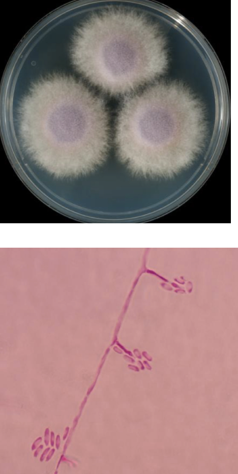 <p>Fusarium oxysporum</p>