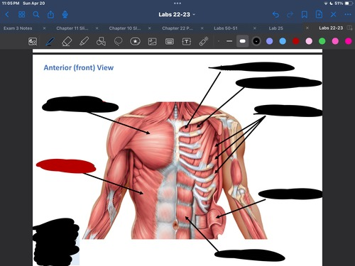 <p>What muscle is this?</p>