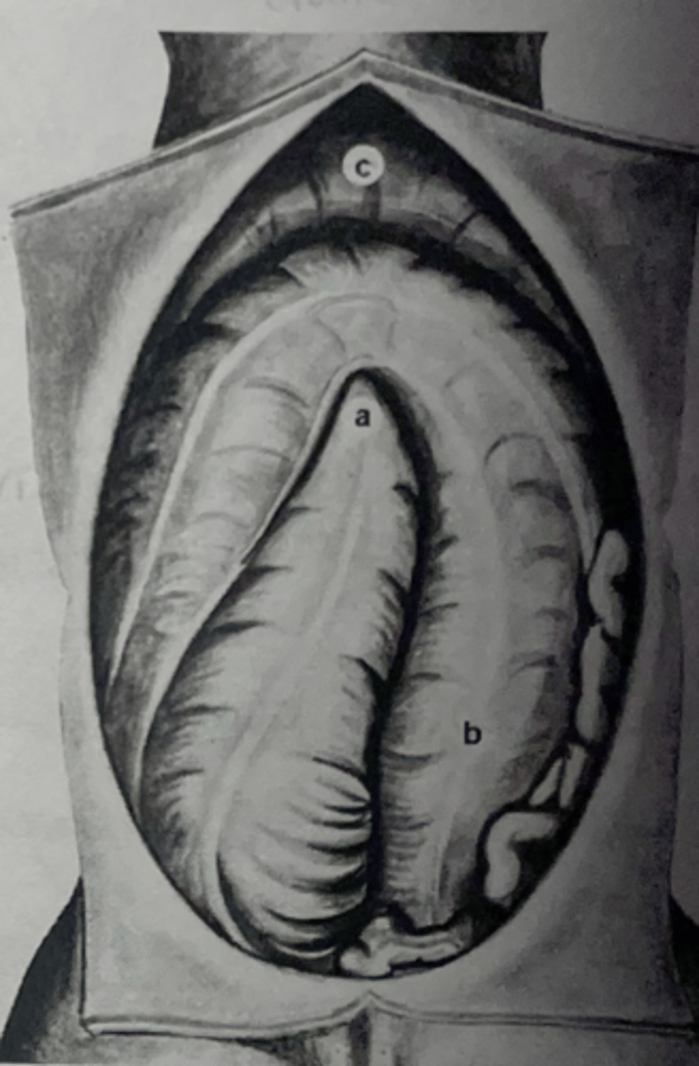 <p>Flexure C is usually located just behind the vertex of the diaphragm which is at which rib?</p>