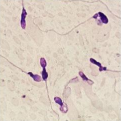 <p>Identify the sperm morphology.</p>