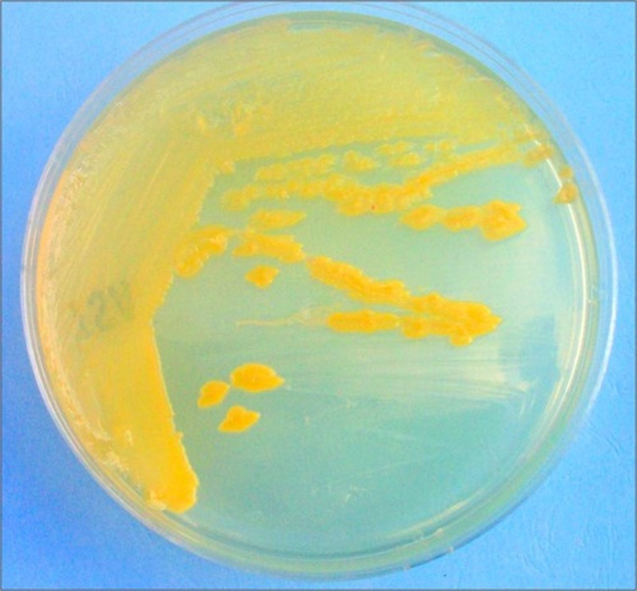 <p>Error in streaking:</p>