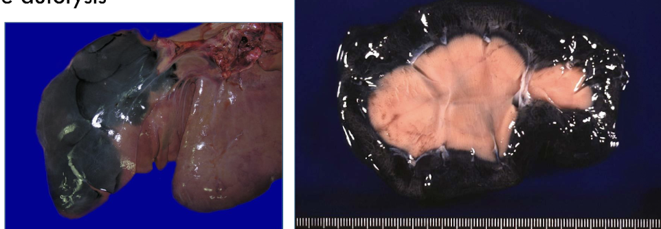<p>blue-green to black discoloration of tissues by iron sulfide deposits</p>