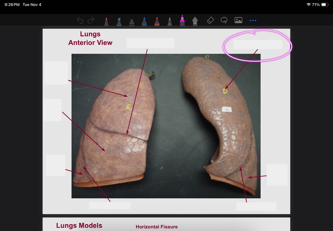 <p>What is this?</p>