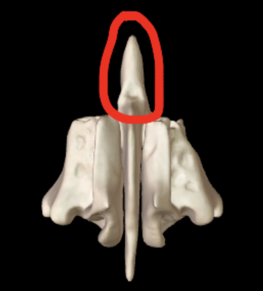<p>What part of the ethmoid is this?</p>