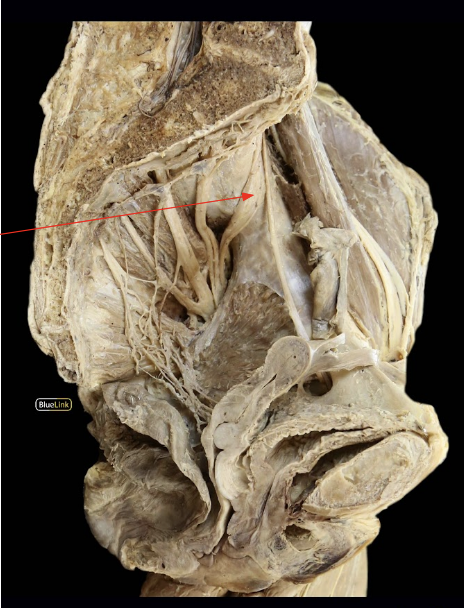 <p>ID Structure and Nerve Roots</p>