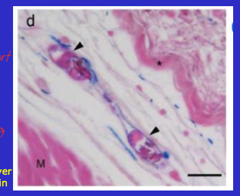 <ul><li><p>irregular </p></li><li><p>sparse, thin fibers (collagen, reticular, elastin)</p></li><li><p>abundant ground substance </p></li><li><p>mostly found beneath surface epithelia which is often a site of immune and or inflammatory reactions </p></li></ul><p></p>