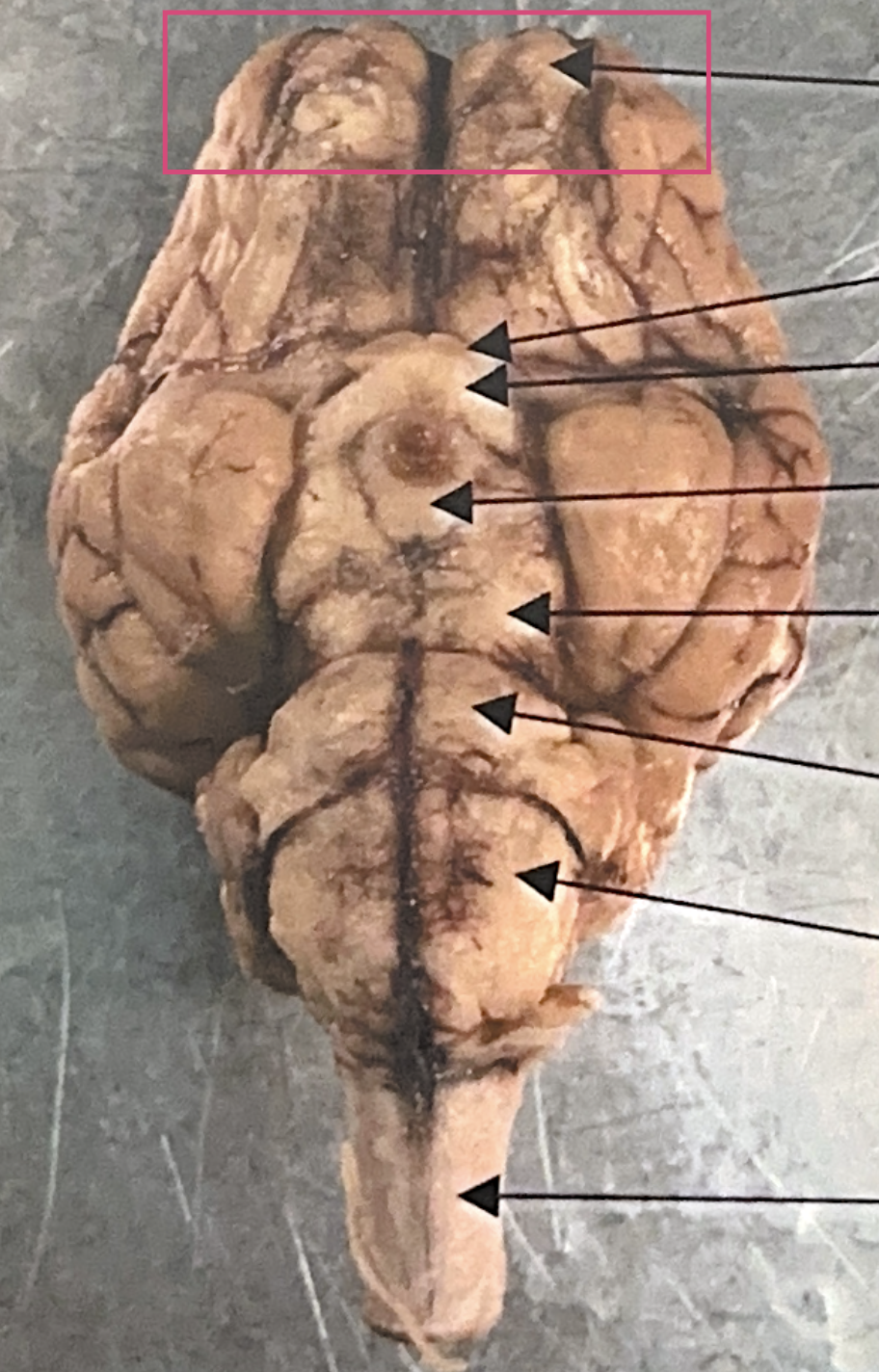 <p>What is this highlighted figure?</p>