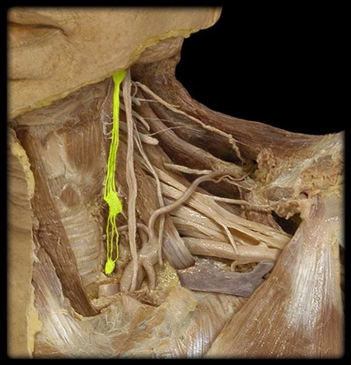 <p><em>identify the structure</em></p>