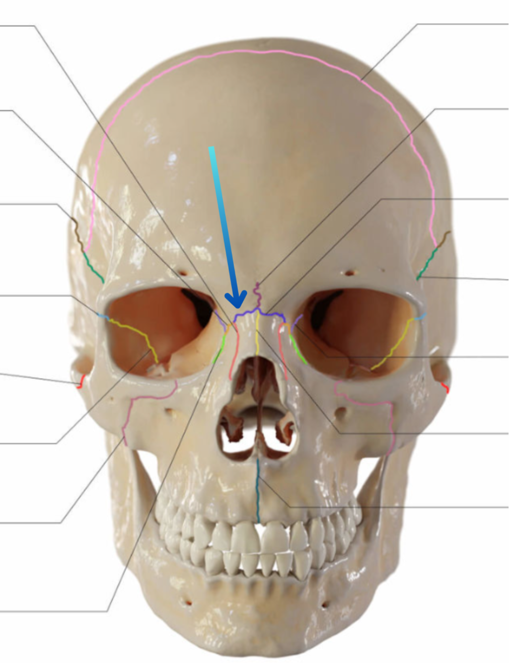 term image