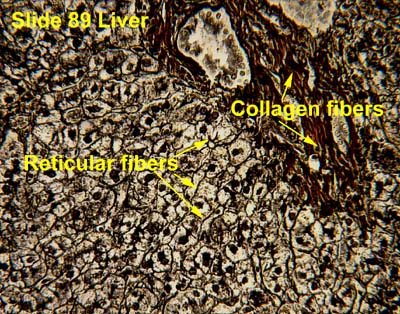 <p>Recticular fibers</p>