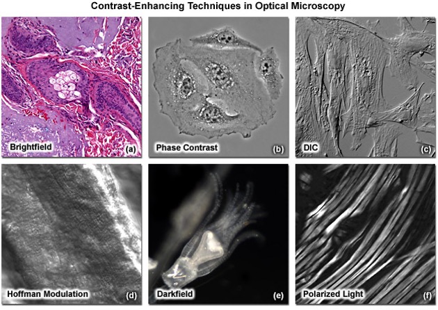 <p>imaging can be performed in many modes including;</p><ul><li><p>brightfield</p></li><li><p>darkfield</p></li><li><p>phase contrast (thin samples)</p></li><li><p>polarised light</p></li><li><p>DIC</p></li><li><p>Hoffman modulation</p></li><li><p>Rheinberg illumination</p></li></ul><p></p>
