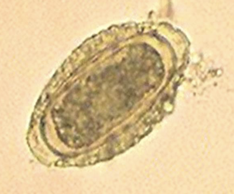 <p>What is the common name of this parasite?</p><p>What is this?</p>