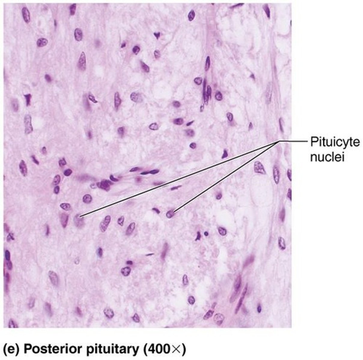 <p>Hormone stored in posterior pituitary, involved in childbirth.</p>