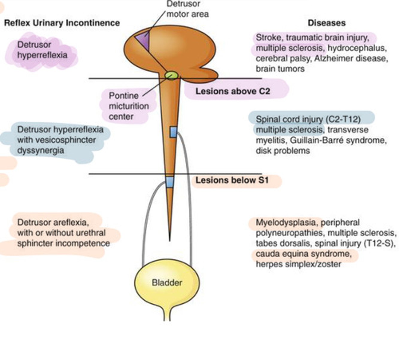 <p>Disorders that interfere with the neural control over the ability to keep urine in the bladder (spastic) or pee urine out (flaccid)</p>