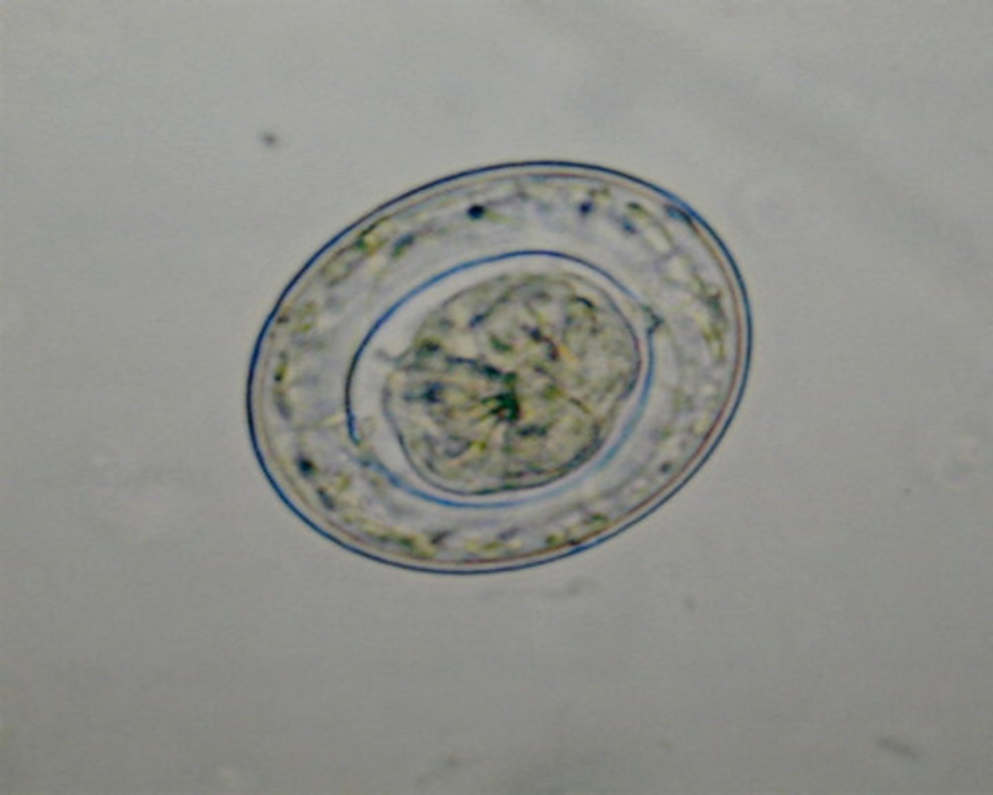 <p>-dwarf tapeworm</p><p>-frequent in humans (most common cestode infection)</p><p>-mostly asymptomatic</p><p>-look for eggs in stool</p><p>-the eggs have polar filaments</p><p>Hymenolepis diminuta (rat tapeworm not common in humans)</p>