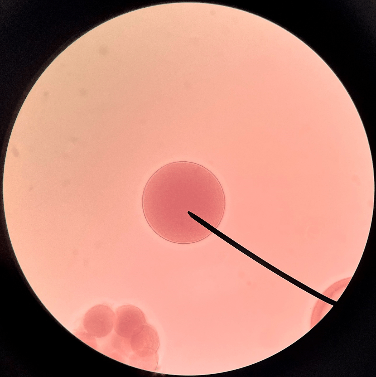 • Slide histology of starfish development.

• A single cell.